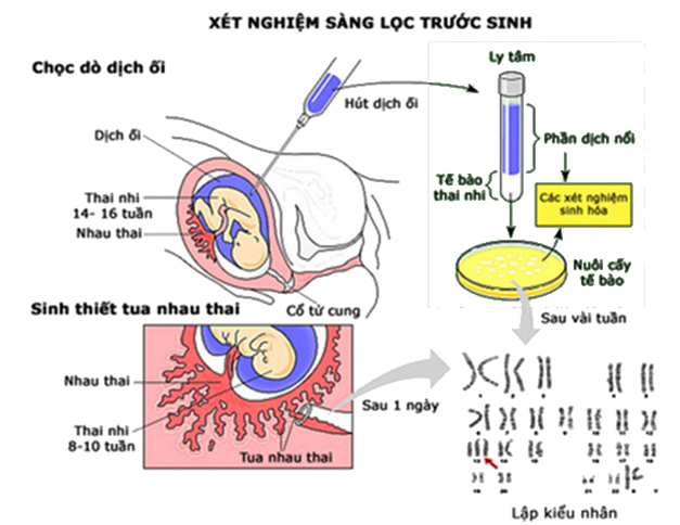 Lý thuyết Sinh học 12 Bài 22: Bảo vệ vốn gen của loài người và một số vấn đề xã hội của di truyền học | Lý thuyết Sinh học 12 đầy đủ, chi tiết nhất