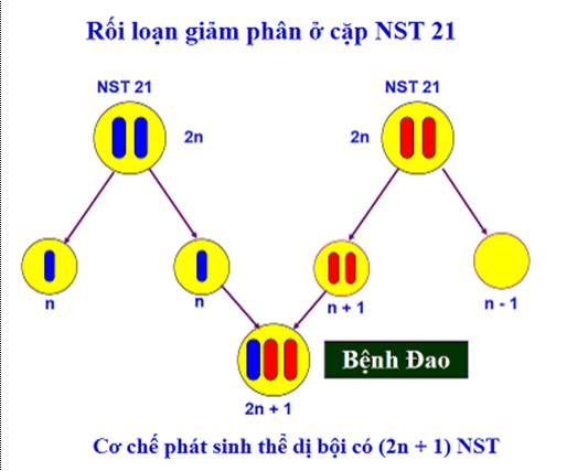 Lý thuyết Sinh học 12 Bài 21: Di truyền y học | Lý thuyết Sinh học 12 đầy đủ, chi tiết nhất